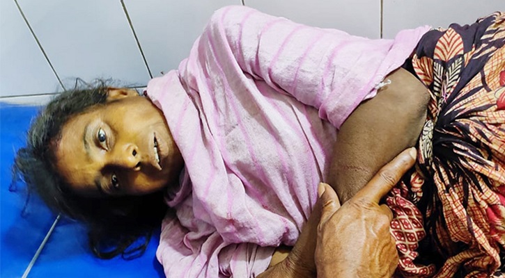 ফুলবাড়ীতে রেলে পা-কাটা নারীর নাম ও পরিচয় মেলেনি এখনও