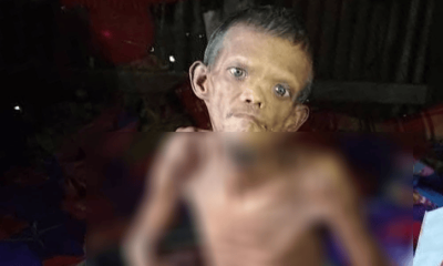 লিভার সিরোসিসে আক্রান্ত জহির বাঁচতে চান