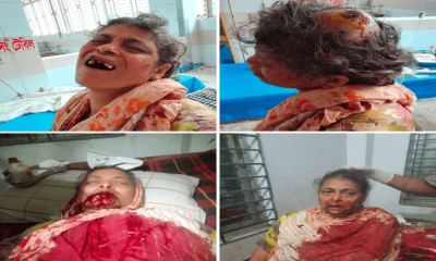 বেলকুচিতে পৈত্রিক সম্পত্তির অধিকার চাওয়ায়  বোনকে মেরে রক্তাক্ত করলেন প্রধান শিক্ষক