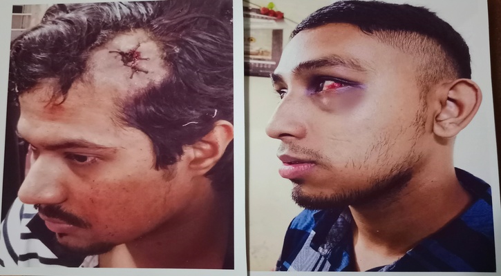 সিরাজগঞ্জে কলেজ অধ্যক্ষ ও সিকিউরিটি গার্ডের মারপিটে ২ শিক্ষাথী আহত