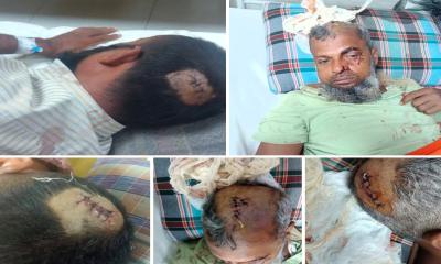 সিরাজগঞ্জে জমিজমা বিরোধে ভাঙ্গচুর ও মারপিটের ঘটনায় একই পরিবারের নারী ও  শিশুসহ আহত -৬