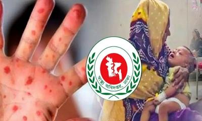 হামের উপসর্গে আরও ৭ শিশুর মৃত্যু, মৃতের সংখ্যা বেড়ে ৬৭৭