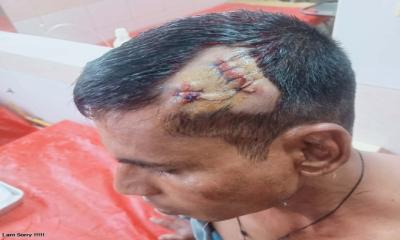 সিরাজগঞ্জে মামলার সাক্ষীকে কোদাল দিয়ে কুপিয়ে জখম