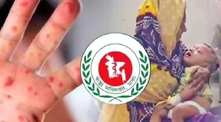 হাম ও হামের উপসর্গে আরও ৯ শিশুর মৃত্যু, উদ্বেগ বাড়ছে দেশজুড়ে