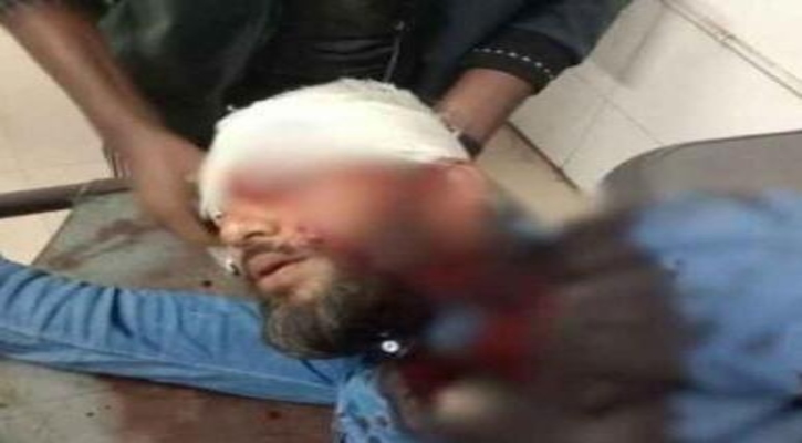 এবার এনসিপির খুলনা বিভাগীয় প্রধানের মাথায় গুলি