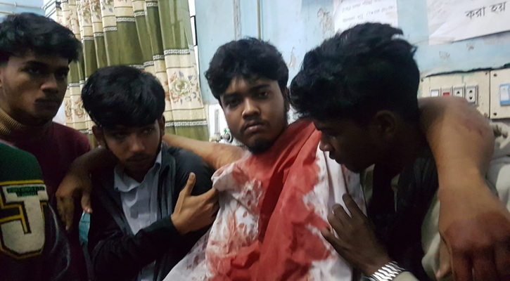 শরীয়তপুরে কিশোর গ্যাংয়ের ছুরিকাঘাতে অপর কিশোর গ্যাং সদস্য গুরুতর আহত