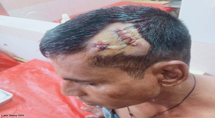 সিরাজগঞ্জে মামলার সাক্ষীকে কোদাল দিয়ে কুপিয়ে জখম